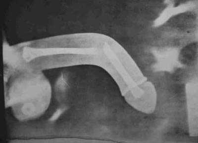 Эротические картинки 40 Добавлено 14-05-2007 Эротические картинки 40 Добавлено 14-05-2007